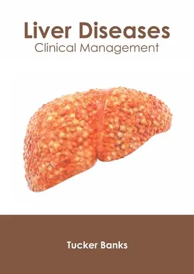 Boli hepatice: Management clinic - Liver Diseases: Clinical Management