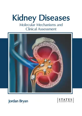Boli renale: Mecanisme moleculare și evaluare clinică - Kidney Diseases: Molecular Mechanisms and Clinical Assessment