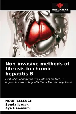 Metode non-invazive de fibroză în hepatita cronică B - Non-invasive methods of fibrosis in chronic hepatitis B
