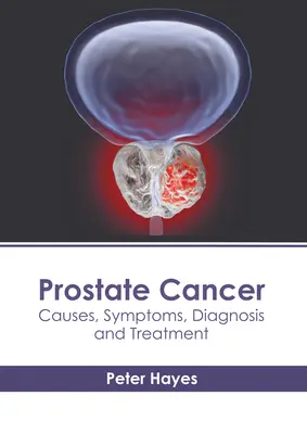 Cancerul de prostată: Cauze, simptome, diagnostic și tratament - Prostate Cancer: Causes, Symptoms, Diagnosis and Treatment