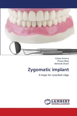 Implant zigomatic - Zygomatic implant