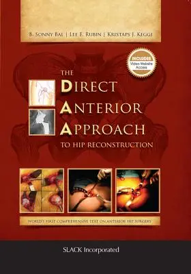 Abordul anterior direct pentru reconstrucția șoldului - The Direct Anterior Approach to Hip Reconstruction