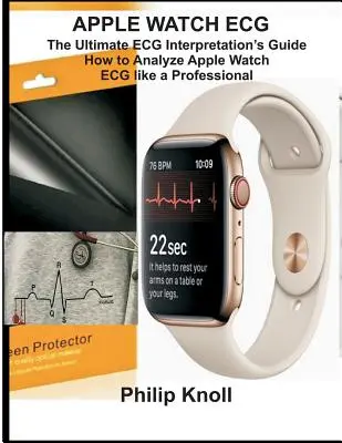 Apple Watch ECG: Ghidul suprem de interpretare ECG; Cum să analizați Apple Watch ECG ca un profesionist - Apple Watch ECG: The Ultimate ECG Interpretation Guide; How to Analyze Apple Watch ECG Like a Professional