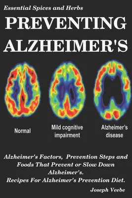 Prevenirea bolii Alzheimer: Factorii Alzheimer, pași de prevenire și alimente care previn sau încetinesc Alzheimerul, rețete pentru prevenirea Alzheimerului D - Preventing Alzheimer's: Alzheimer's Factors, Prevention Steps and Foods That Prevent or Slow Alzheimer's, Recipes for Alzheimer's Prevention D