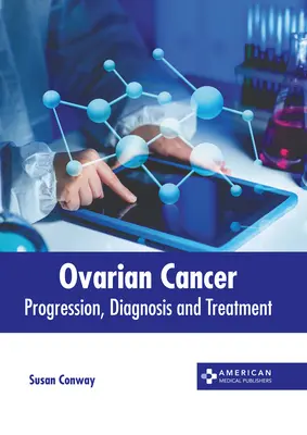 Cancerul ovarian: Progresia, diagnosticul și tratamentul - Ovarian Cancer: Progression, Diagnosis and Treatment