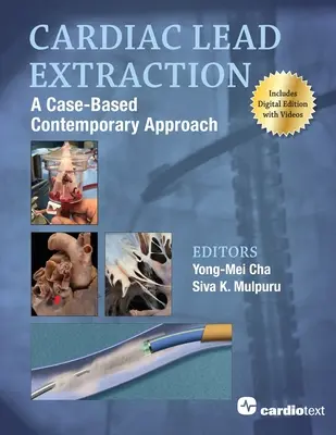 Cardiac Lead Extraction: O abordare contemporană bazată pe cazuri - Cardiac Lead Extraction: A Case-Based Contemporary Approach