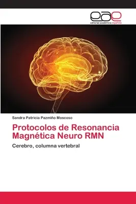 Protocoale de rezonanță magnetică neuro RMN - Protocolos de Resonancia Magntica Neuro RMN
