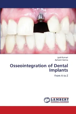 Osteointegrarea implanturilor dentare - Osseointegration of Dental Implants