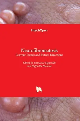 Neurofibromatoza: Tendințe actuale și direcții viitoare - Neurofibromatosis: Current Trends and Future Directions