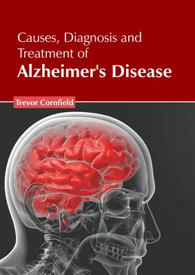 Cauze, diagnostic și tratament ale bolii Alzheimer - Causes, Diagnosis and Treatment of Alzheimer's Disease
