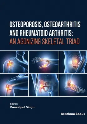 Osteoporoza, osteoartrita și artrita reumatoidă: O triadă scheletică agonizantă - Osteoporosis, Osteoarthritis and Rheumatoid Arthritis: An Agonizing Skeletal Triad