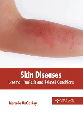 Bolile de piele: Eczemă, psoriazis și afecțiuni conexe - Skin Diseases: Eczema, Psoriasis and Related Conditions