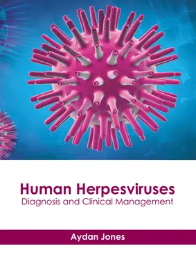 Herpesviruși umani: Diagnosticul și managementul clinic - Human Herpesviruses: Diagnosis and Clinical Management
