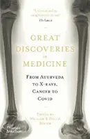 Mari descoperiri în medicină - De la Ayurveda la razele X, de la cancer la Covid - Great Discoveries in Medicine - From Ayurveda to X-rays, Cancer to Covid