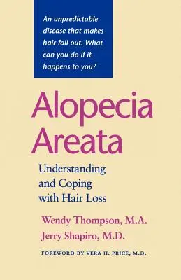 Alopecia Areata: Understanding and Coping with Hair Loss (Înțelegerea și gestionarea căderii părului) - Alopecia Areata: Understanding and Coping with Hair Loss