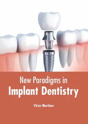 Noi paradigme în implantologie dentară (New Paradigms in Implant Dentistry) - New Paradigms in Implant Dentistry