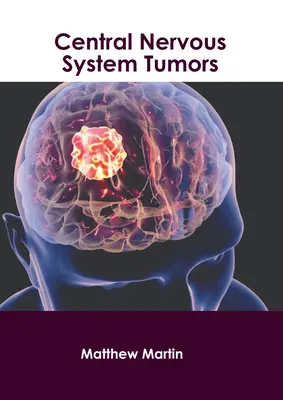 Tumorile sistemului nervos central - Central Nervous System Tumors