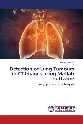 Detectarea tumorilor pulmonare în imaginile CT cu ajutorul software-ului Matlab - Detection of Lung Tumours in CT Images using Matlab software