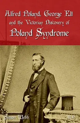Alfred Poland, George Elt și descoperirea victoriană a sindromului Poland - Alfred Poland, George Elt and the Victorian Discovery of Poland Syndrome