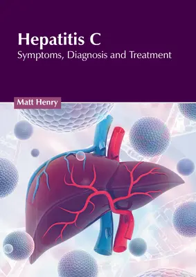 Hepatita C: Simptome, diagnostic și tratament - Hepatitis C: Symptoms, Diagnosis and Treatment