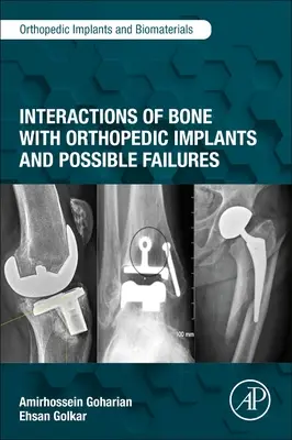 Interacțiunile osului cu implanturile ortopedice și posibilele defecțiuni - Interactions of Bone with Orthopedic Implants and Possible Failures