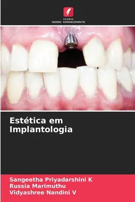 Esttica în implantologie - Esttica em Implantologia