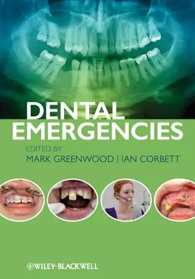 Urgențe dentare - Dental Emergencies