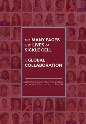 Numeroasele fețe și vieți ale celulelor falciforme - o colaborare globală - The Many Faces and Lives of Sickle Cell - A Global Collaboration