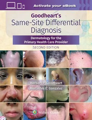 Goodheart's Same-Site Differential Diagnosis: Dermatologie pentru furnizorul de asistență medicală primară - Goodheart's Same-Site Differential Diagnosis: Dermatology for the Primary Health Care Provider