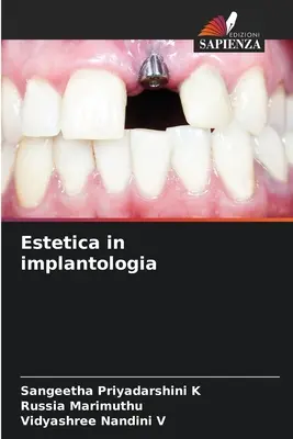 Estetica în implantologie - Estetica in implantologia