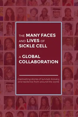 Numeroasele fețe și vieți ale celulelor falciforme - o colaborare globală - The Many Faces and Lives of Sickle Cell - A Global Collaboration