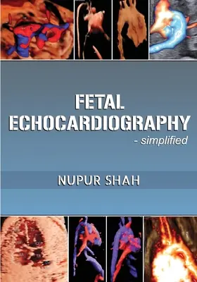 Ecocardiografie fetală - simplificată - Fetal Echocardiography - Simplified