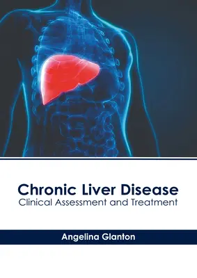 Boala hepatică cronică: Evaluare clinică și tratament - Chronic Liver Disease: Clinical Assessment and Treatment