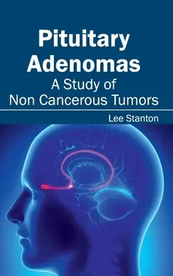 Pituitary Adenomas: Un studiu al tumorilor necanceroase - Pituitary Adenomas: A Study of Non Cancerous Tumors