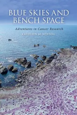 Cer albastru și spațiu în bancă: Aventuri în cercetarea cancerului - Blue Skies and Bench Space: Adventures in Cancer Research