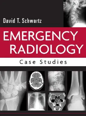 Radiologie de urgență: Studii de caz - Emergency Radiology: Case Studies