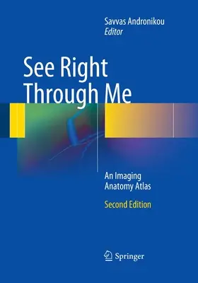 Vedeți direct prin mine: Un atlas anatomic pentru imagistică - See Right Through Me: An Imaging Anatomy Atlas