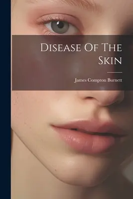 Boli ale pielii - Disease Of The Skin