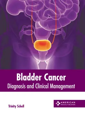Cancerul vezicii urinare: Diagnostic și management clinic - Bladder Cancer: Diagnosis and Clinical Management