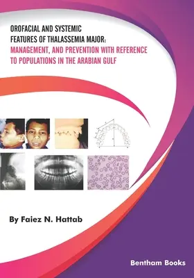 Caracteristici orofazale și sistemice ale talasemiei majore: Management și prevenire cu referire la populațiile din Golful Arabiei - Orofacial and Systemic Features of Thalassemia Major: Management, and Prevention with Reference to Populations in the Arabian Gulf