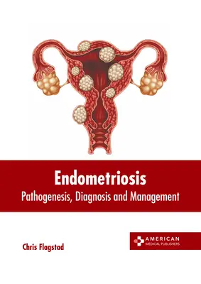 Endometrioza: Patogenie, diagnostic și management - Endometriosis: Pathogenesis, Diagnosis and Management