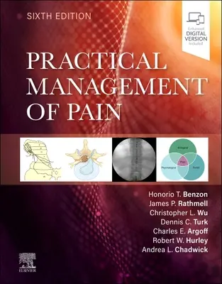 Managementul practic al durerii - Practical Management of Pain