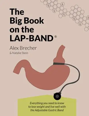 The Big Book on the Lap-Band: Tot ce trebuie să știți pentru a pierde în greutate și a trăi bine cu banda gastrică ajustabilă - The Big Book on the Lap-Band: Everything You Need to Know to Lose Weight and Live Well with the Adjustable Gastric Band