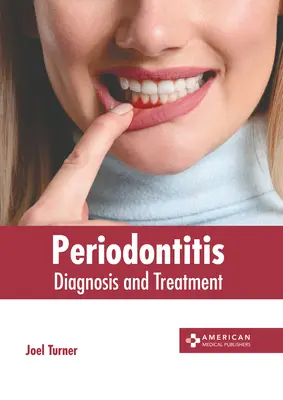 Parodontită: Diagnostic și tratament - Periodontitis: Diagnosis and Treatment