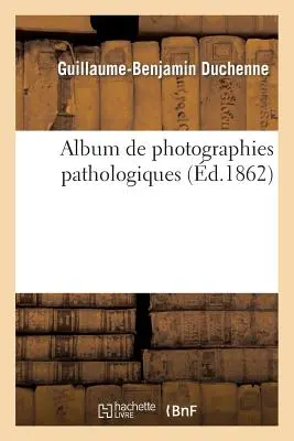 Album de Photographies Pathologiques, Complmentaire Du Livre Intitulat de l'lectrisation Localise - Album de Photographies Pathologiques, Complmentaire Du Livre Intitul de l'lectrisation Localise