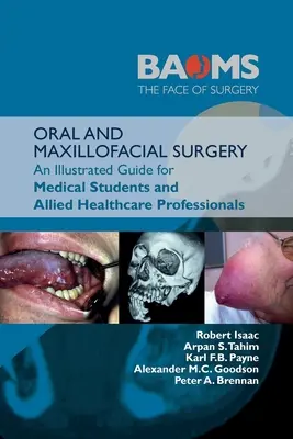Chirurgie orală și maxilofacială: An Illustrated Guide for Medical Students and Allied Healthcare Professionals:: Un ghid ilustrat pentru studenții la medicină - Oral and Maxillofacial Surgery: An Illustrated Guide for Medical Students and Allied Healthcare Professionals:: An Illustrated Guide for Medical Stude