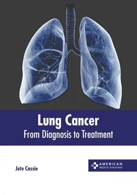Cancerul pulmonar: De la diagnostic la tratament - Lung Cancer: From Diagnosis to Treatment
