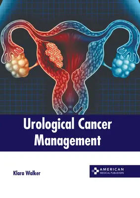 Managementul cancerului urologic - Urological Cancer Management