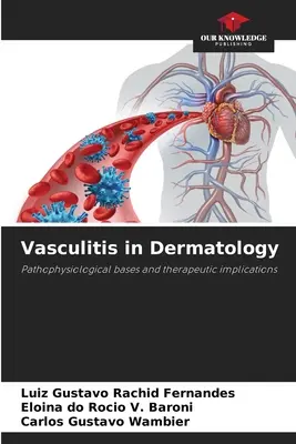 Vasculita în dermatologie - Vasculitis in Dermatology