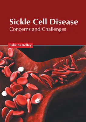 Boala celulelor falciforme: Preocupări și provocări - Sickle Cell Disease: Concerns and Challenges